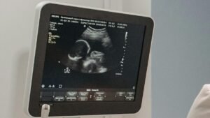 سيدالين شراب والحمل
