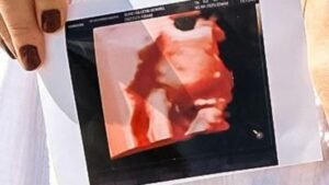 ديستيل اقراص والحمل