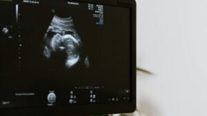 جانتوليف اقراص للحامل