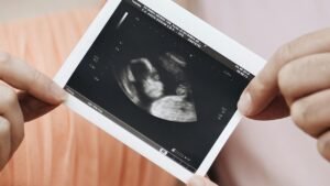 بانجيستازول 40 مجم والحمل