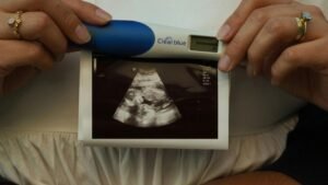 بروتوفكس 40 مجم والحمل