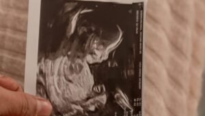 فاموتاك 40 مجم والحمل