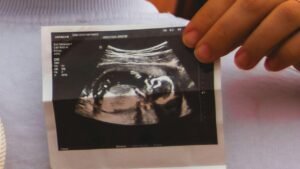 أضرار كونترولوك للحامل