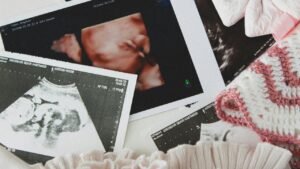 ازجوفانس 40 مجم والحمل