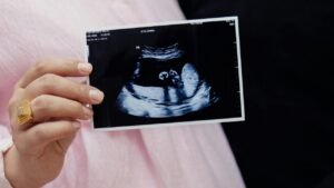 فونافوب 20 مجم والحمل