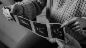 نافوبروكسين اقراص للحامل