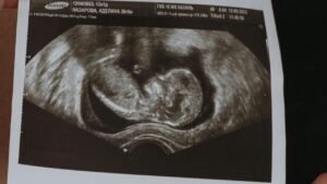 هل حبوب فومينور للحامل تضر الجنين؟