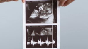 ستربتوكين للاسهال للحامل