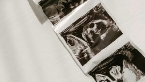 تراستنال شراب وأقراص للحامل