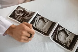هل حبوب اندرال تزيد الوزن ؟ وهل آمن للحامل؟ 